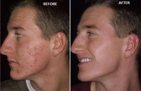 Possess Wound Healing Properties Possess Wound Healing PropertiesÂ