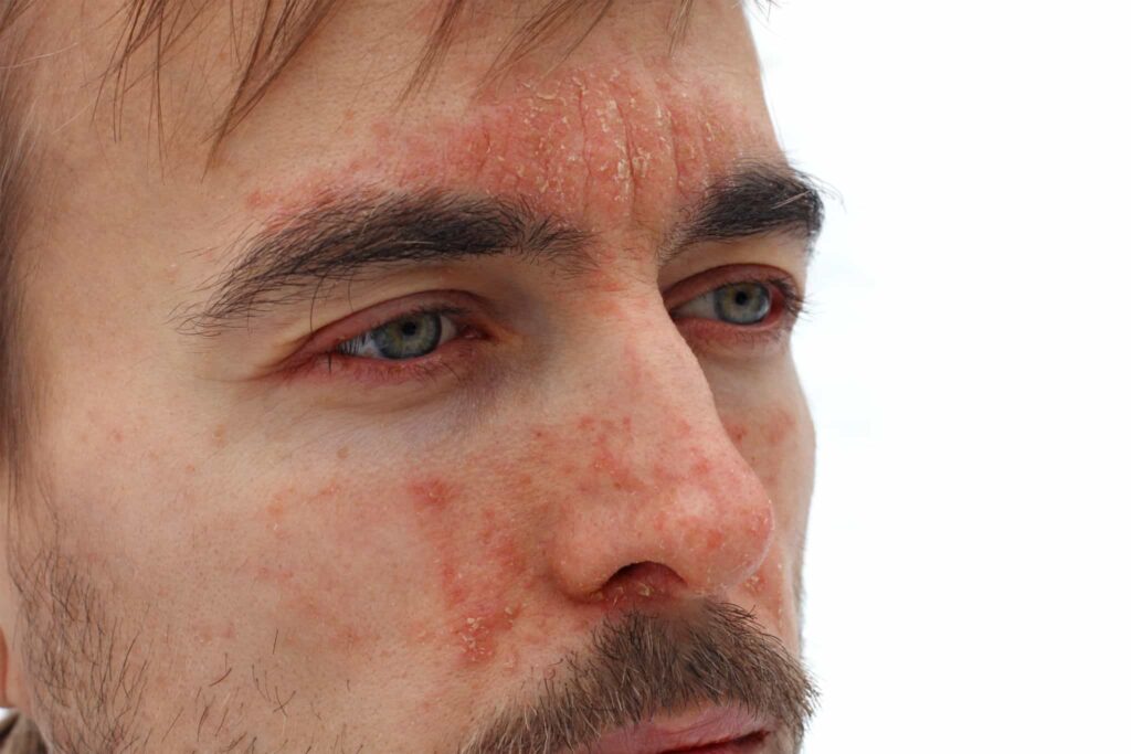 Don’t Overdry Your Skin Don’t Overdry Your Skin
