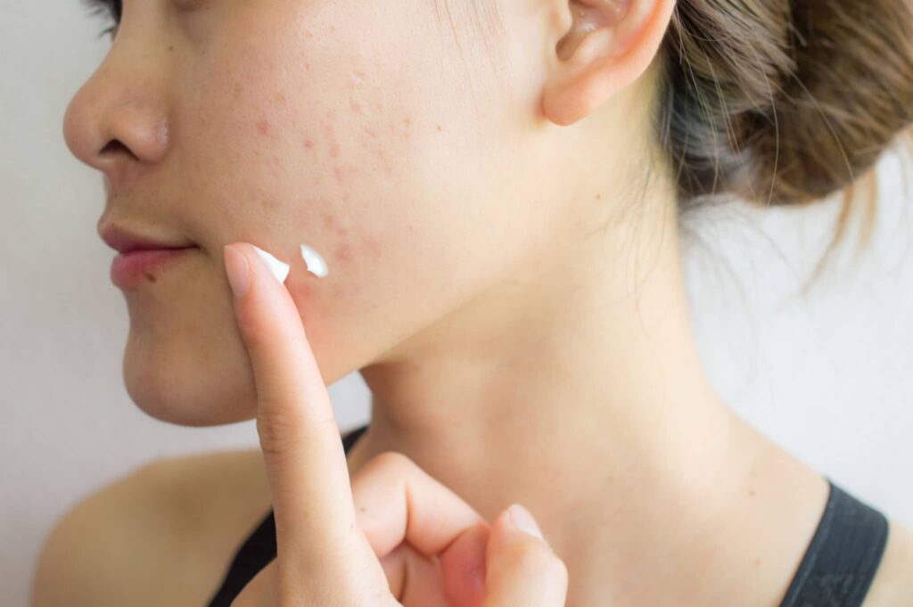 Treatments are Quick Remedies Treatments are Quick Remedies