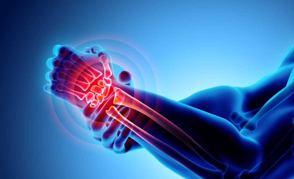 2. Improves Bone Strength 2. Improves Bone Strength