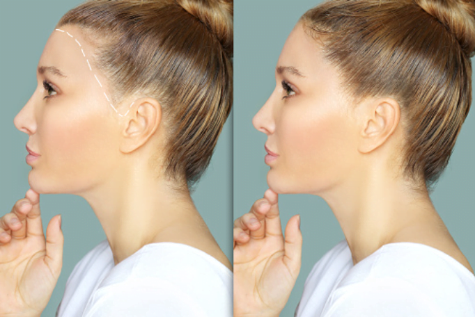 1. Help Promote Hair Growth 1. Help Promote Hair Growth