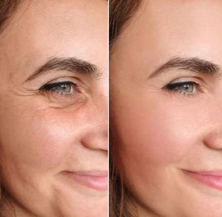4. Reduces wrinkles and fine lines 4. Reduces wrinkles and fine lines